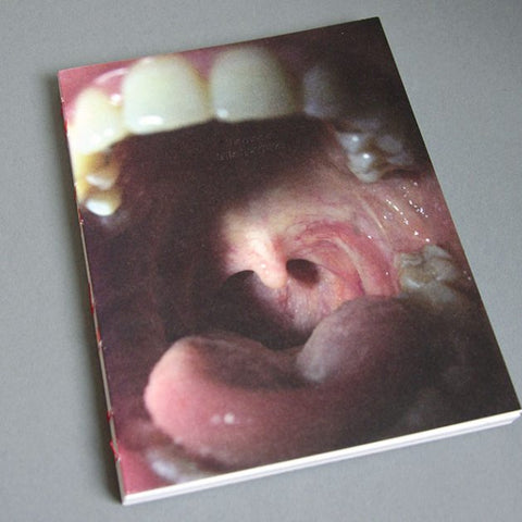 Nausea | Lilia Limiyan